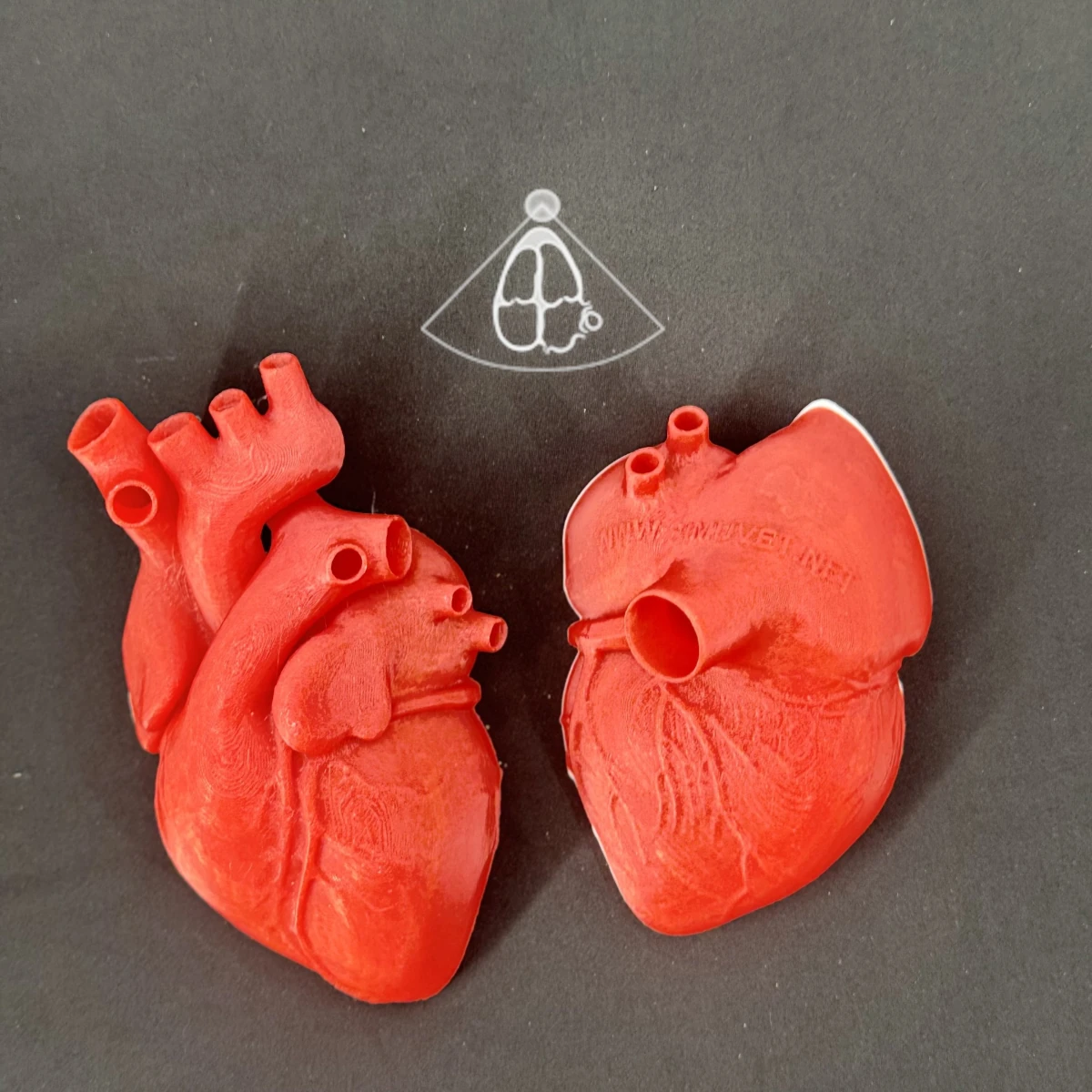 External view of the heart