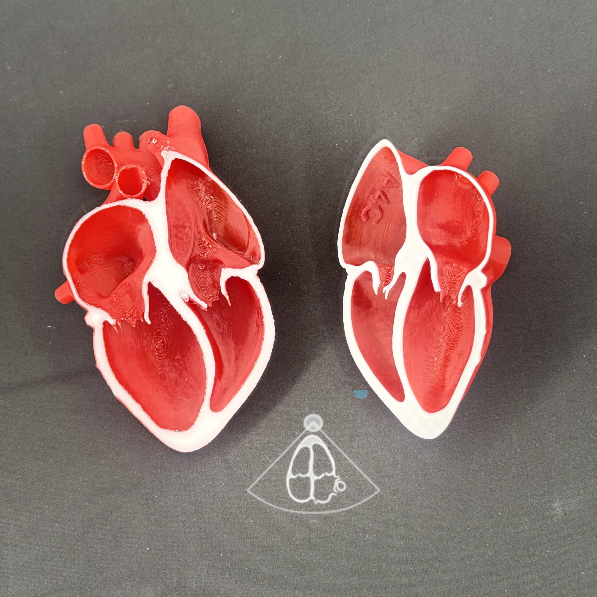 Apical 4 Chamber (A4C) echocardiogram view model