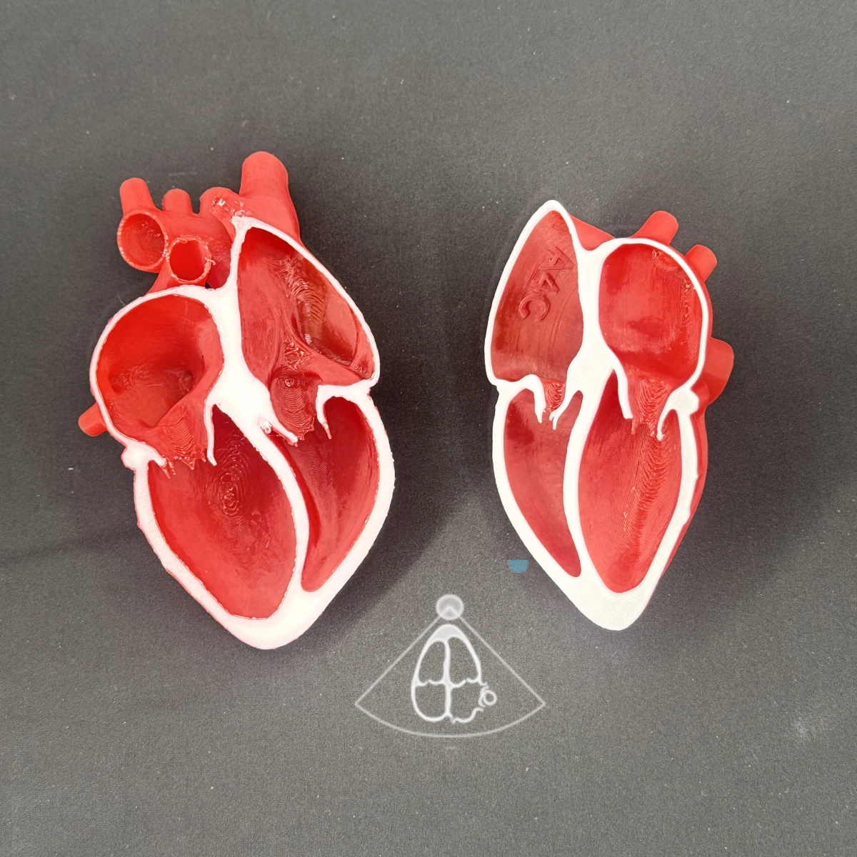 Apical 4 Chamber