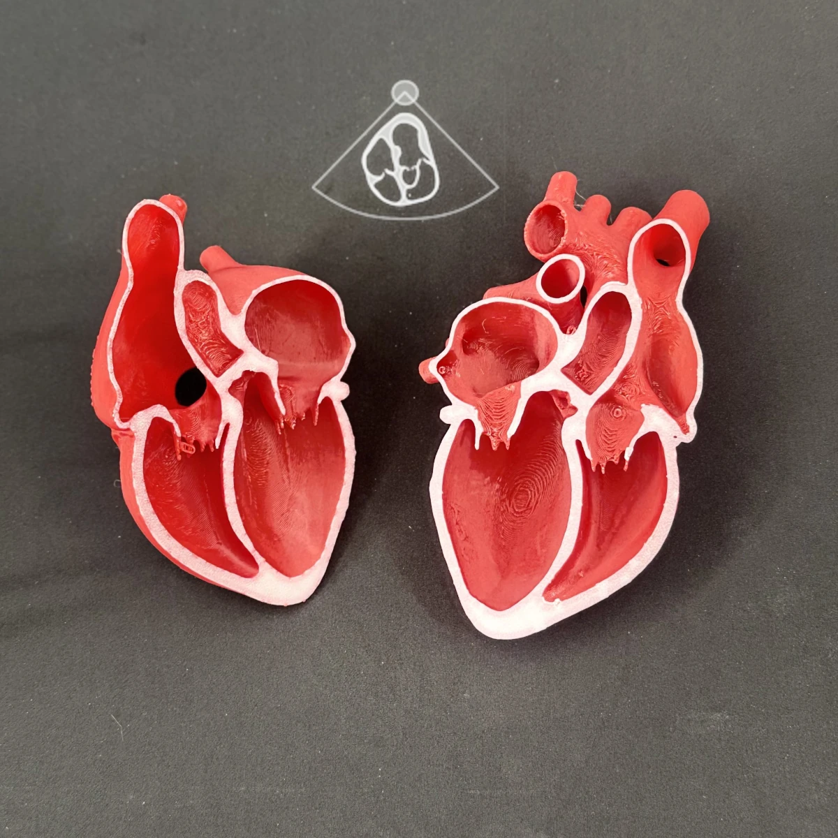 Apical 5 Chamber