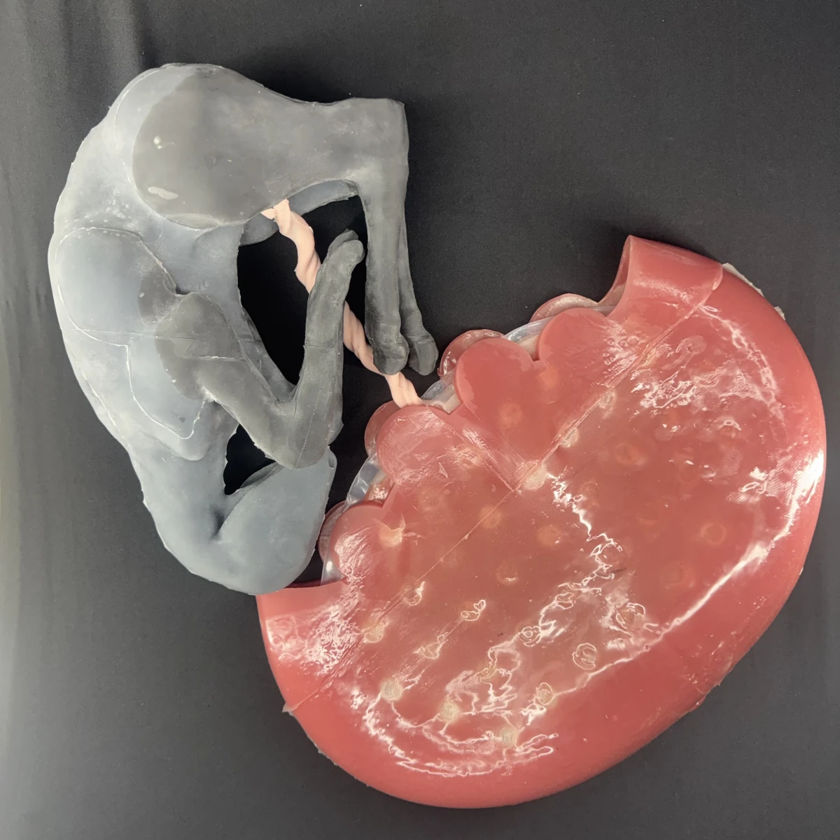 Uterus with Uteroplacental Structures