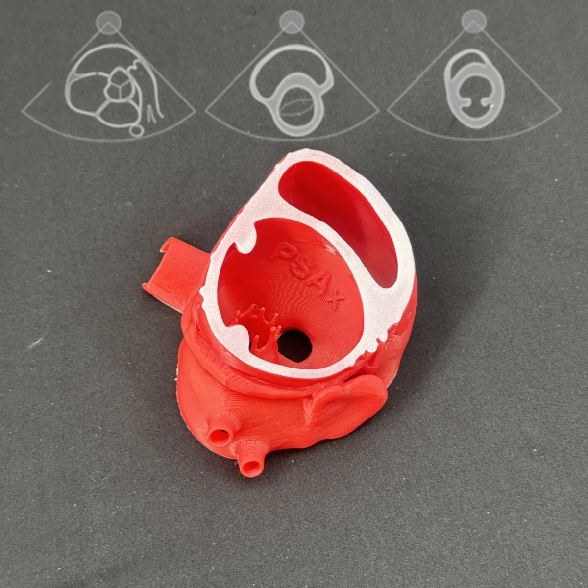 Parasternal Short Axis - Middle section
