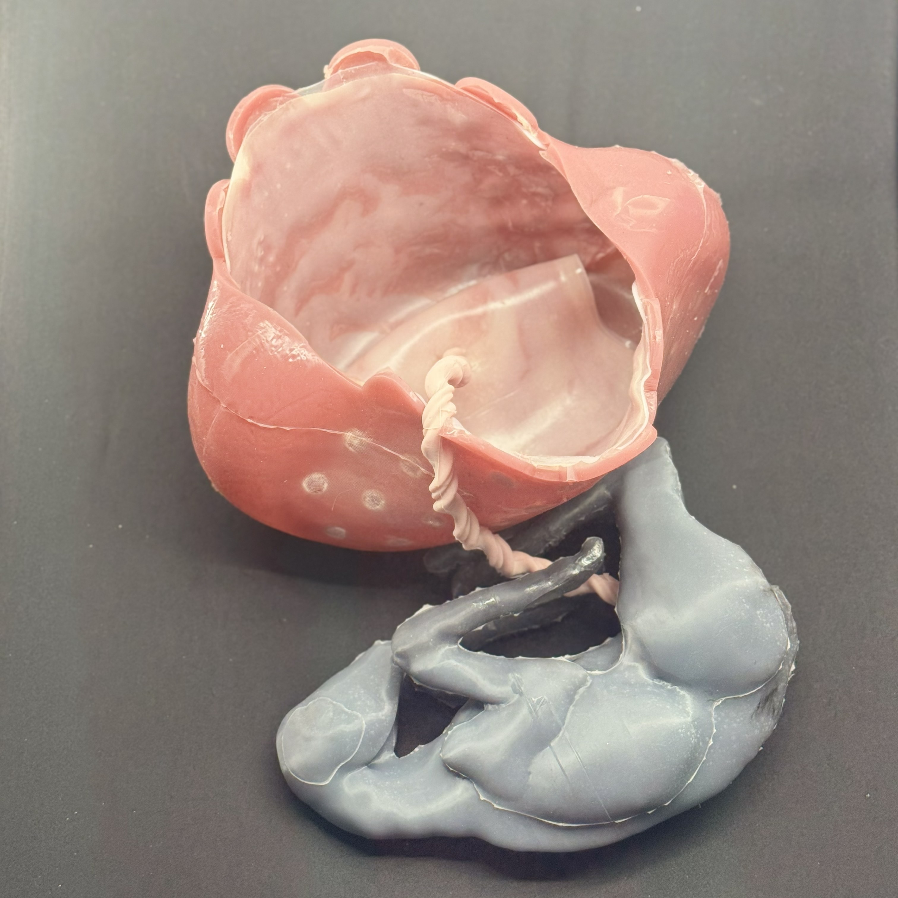 Small ruminant cesarean - lamb-placenta-umbilical-Uteroplacental Structures